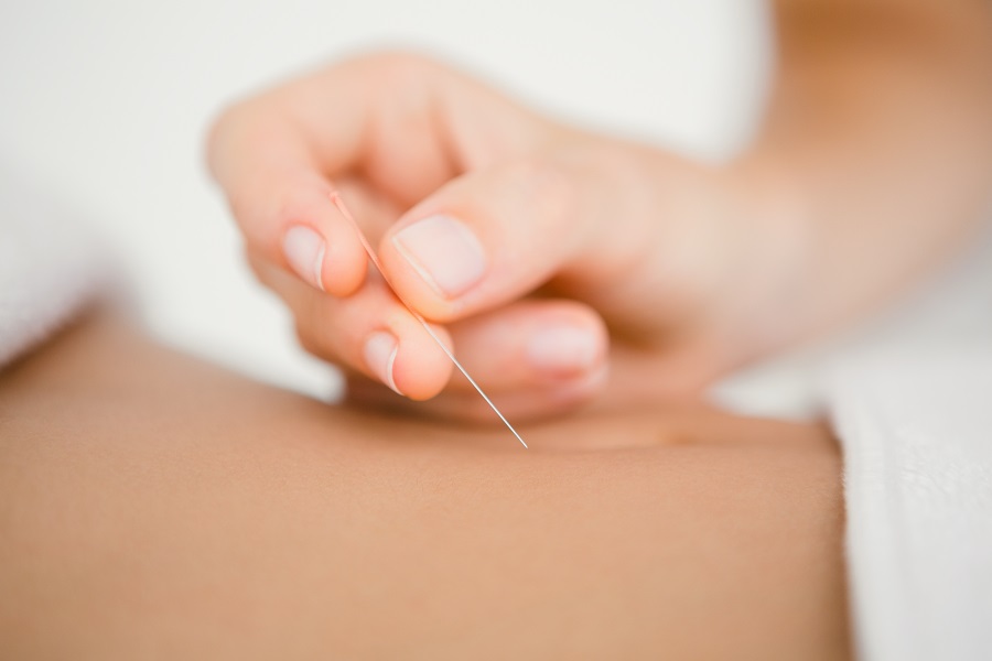 Sage femme acupunctrice Paris - Lisa Vieau